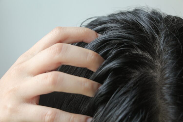 rambut-lepek