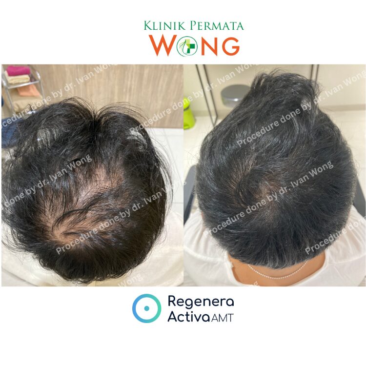 regenera-web